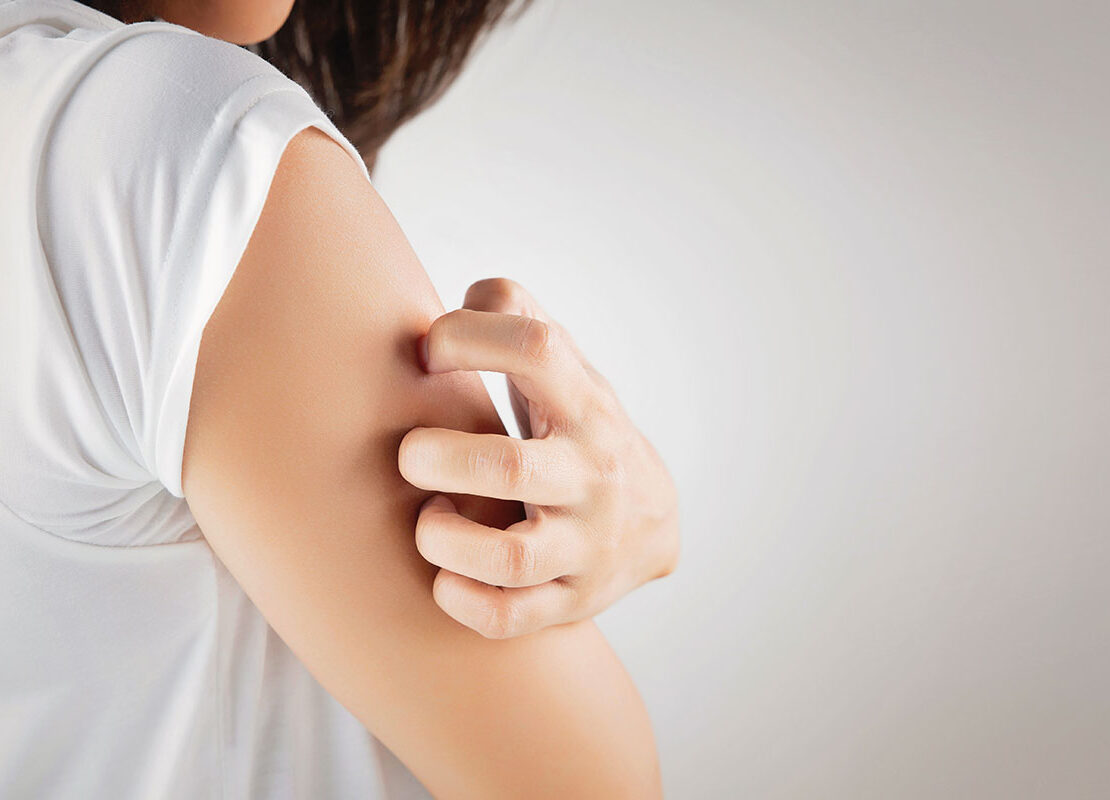 Remède allergie cutanée