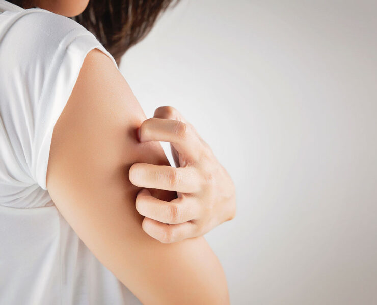 Remède allergie cutanée