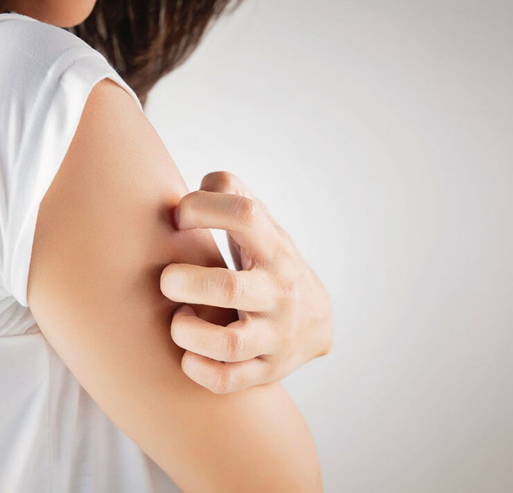 Remède allergie cutanée