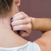 Soigner le zona avec du vinaigre