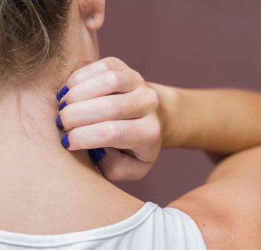 Soigner le zona avec du vinaigre